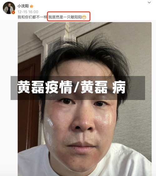 黄磊疫情/黄磊 病-第2张图片