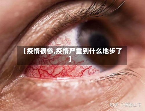 【疫情很惨,疫情严重到什么地步了】-第2张图片