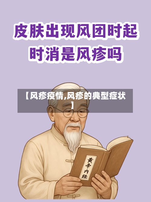 【风疹疫情,风疹的典型症状】-第3张图片