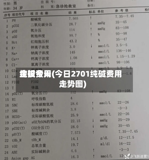 纯碱费用
金投今天(今日2701纯碱费用
走势图)-第2张图片