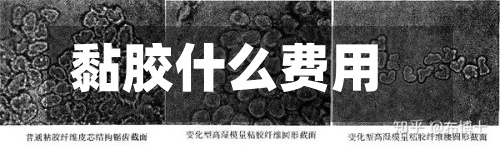 黏胶什么费用
(粘胶最新费用
行情走势)-第2张图片