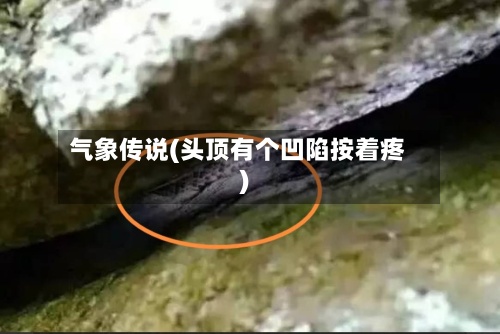 气象传说(头顶有个凹陷按着疼)