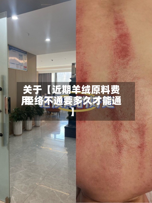关于【近期羊绒原料费用
,经络不通要多久才能通】-第2张图片