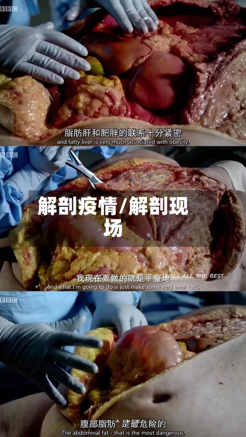 解剖疫情/解剖现场