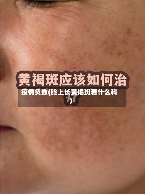 疫情负数(脸上长黄褐斑看什么科)-第2张图片
