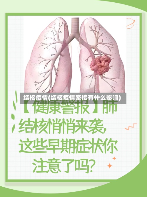 结核疫情(结核疫情密接有什么影响)-第3张图片